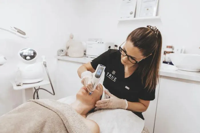 A microneedling treatment being carried out at the True Skin and Laser clinic
